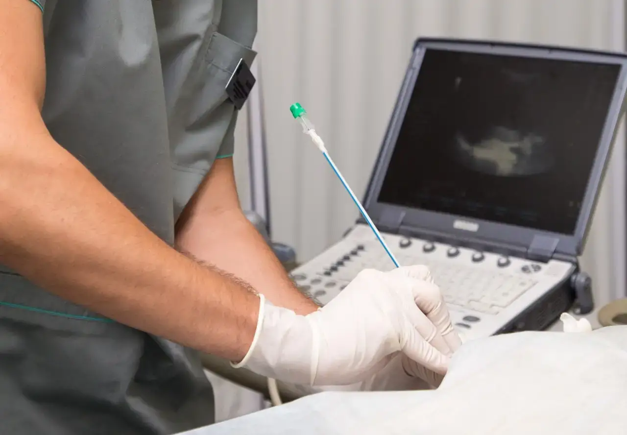 Нефростомія, що потрібно знати