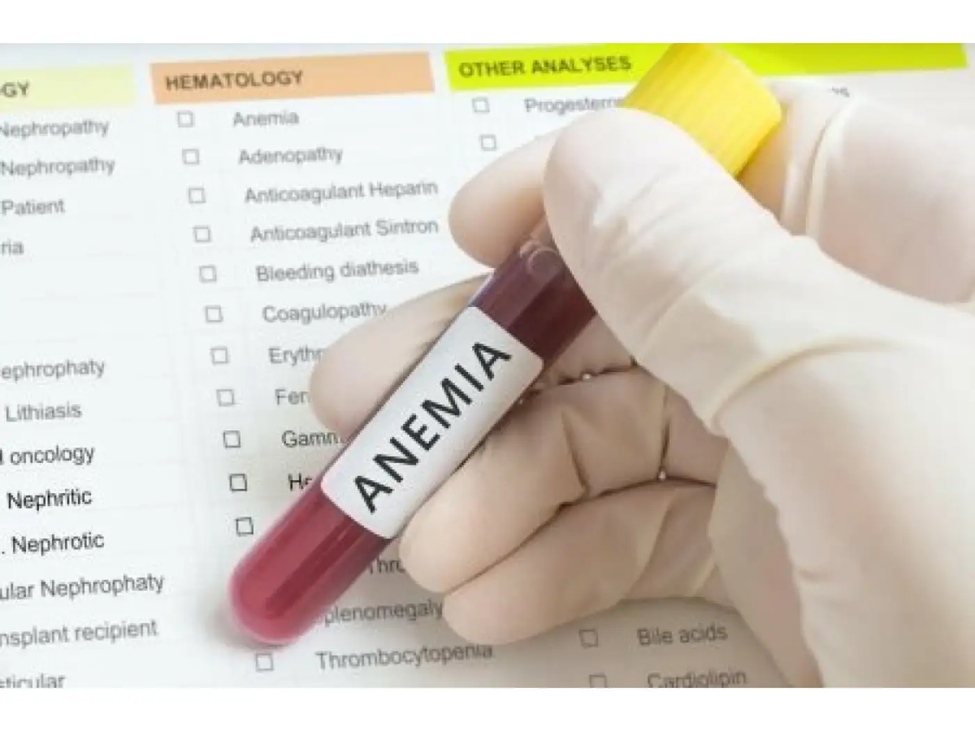 Як оцінити баланс заліза в організмі?