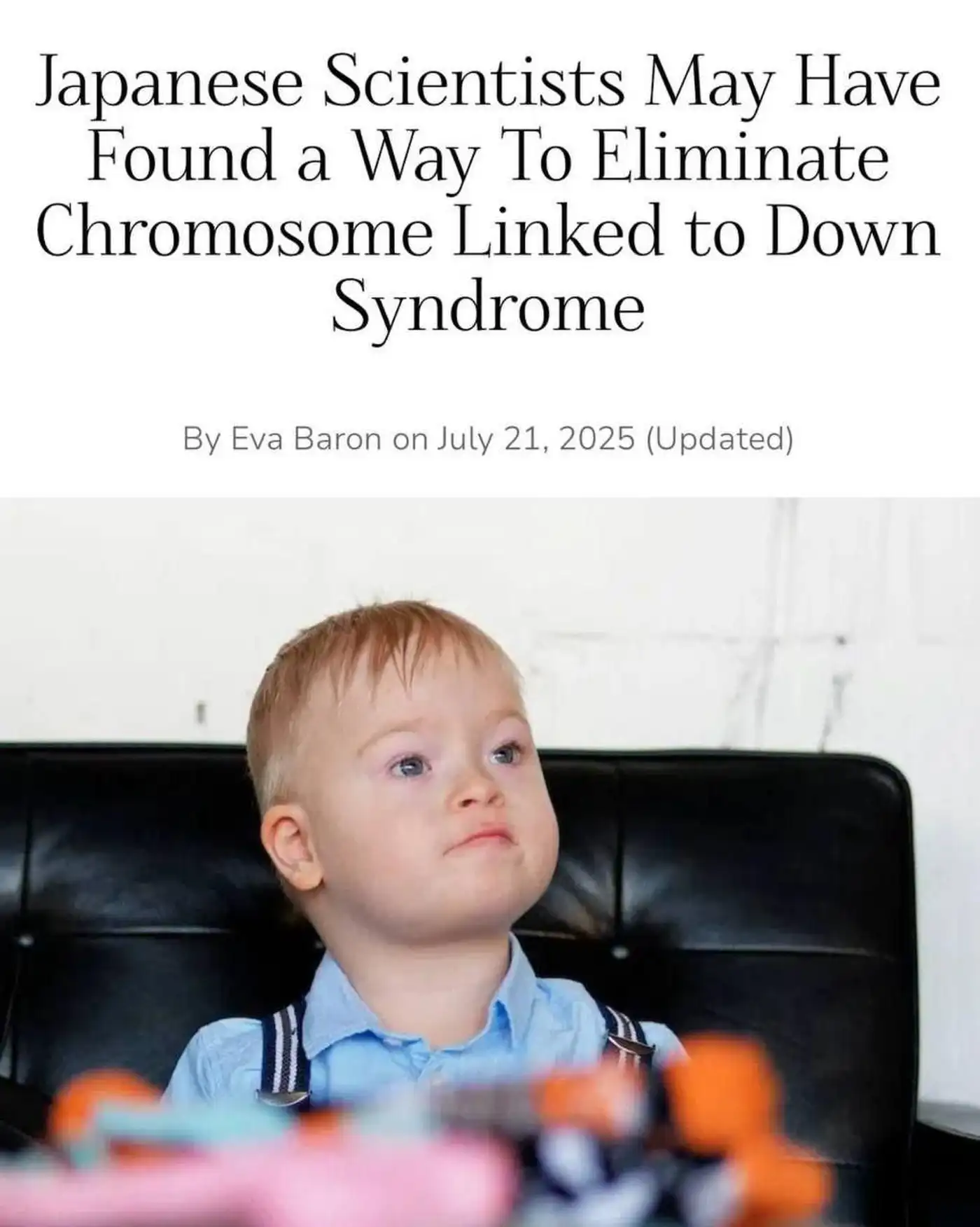 Японские учёные сделали шаг к лечению синдрома Дауна на клеточном уровне