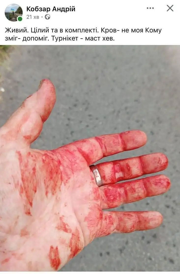 Россия ударила по выставке оружейников под Киевом 2 temp photo 21432